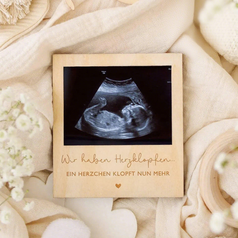 Ultrasound Pregnancy Announcem - Photo Booth Frame recension och pris